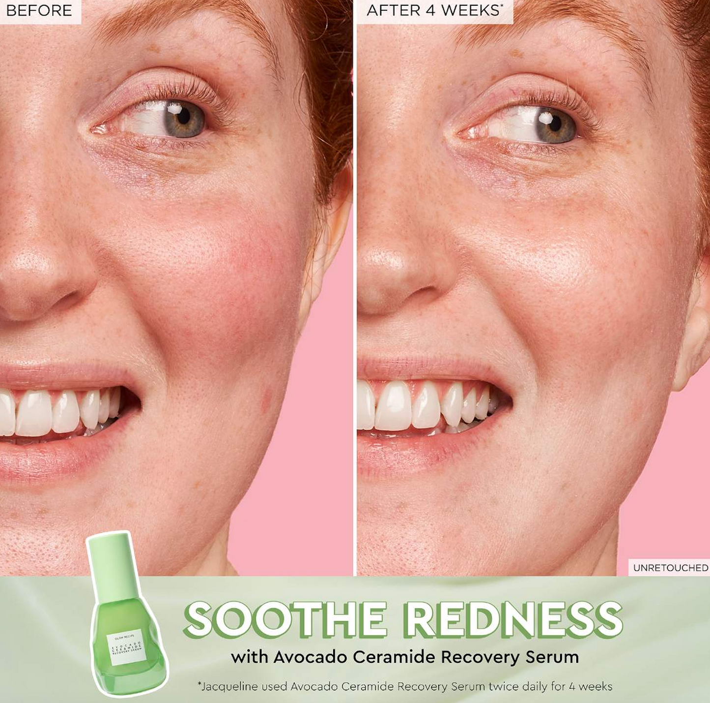 Glow Recipe Skin Barrier Serum